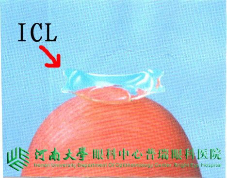 關(guān)注高度近視——ICL是個啥？