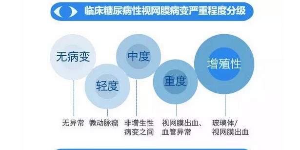 你造嗎？糖尿病晚期眼睛會(huì)致盲！
