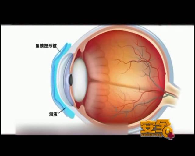 一夜之間真的能改變視力嗎？