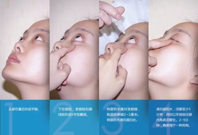 眼藥水你點(diǎn)對(duì)了嗎？快來(lái)看看！