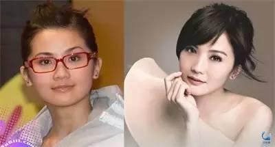 那些近視戴鏡暴丑的女明星們是做了什么變美了？？？
